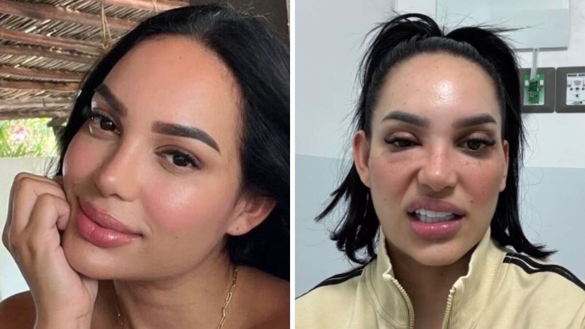 Video | Andrea Valdiri mostró las consecuencias de la enfermedad que sufre