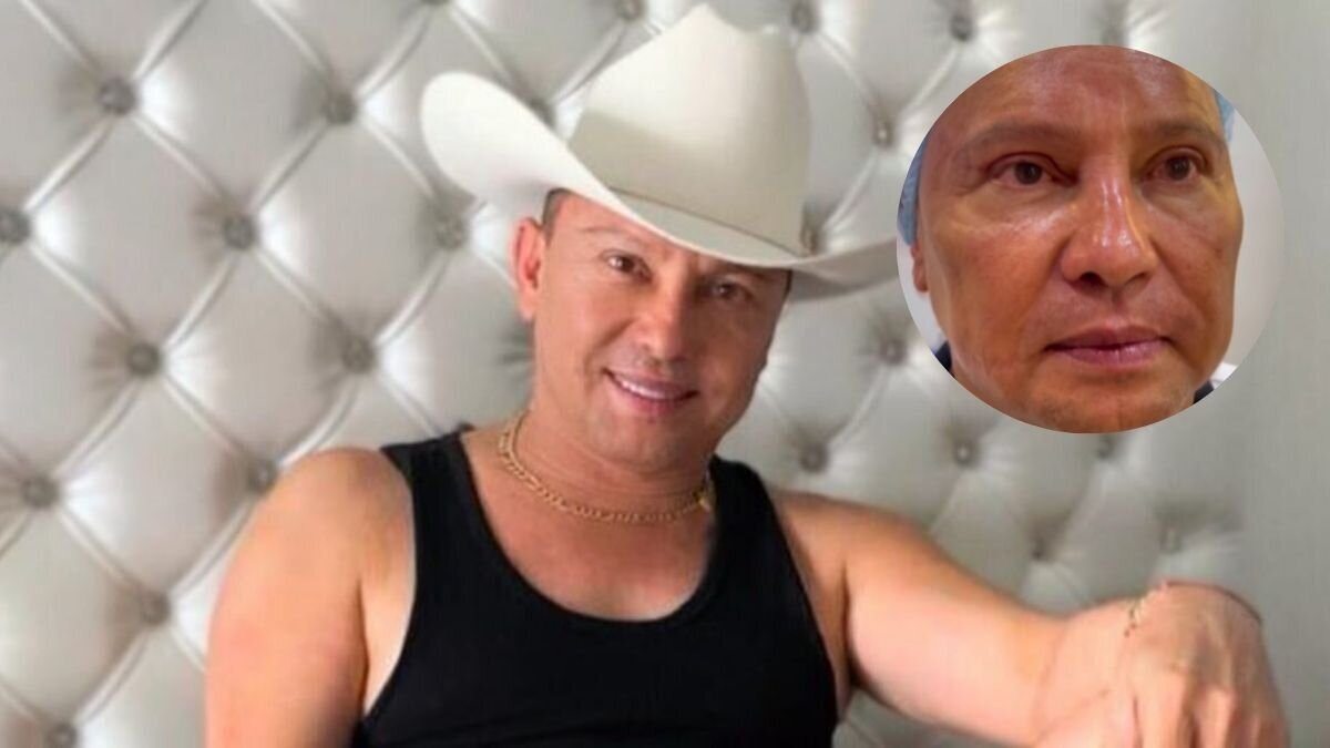 ¿Irreconocible? Así es como se ve Giovanny Ayala después de su nuevo procedimiento de rejuvenecimiento