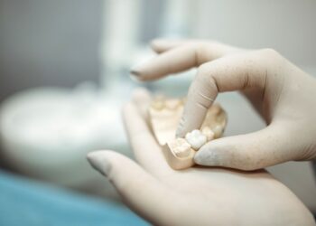 ¿Dientes dañados? Esto es todo lo que necesitas saber sobre las coronas cerámicas