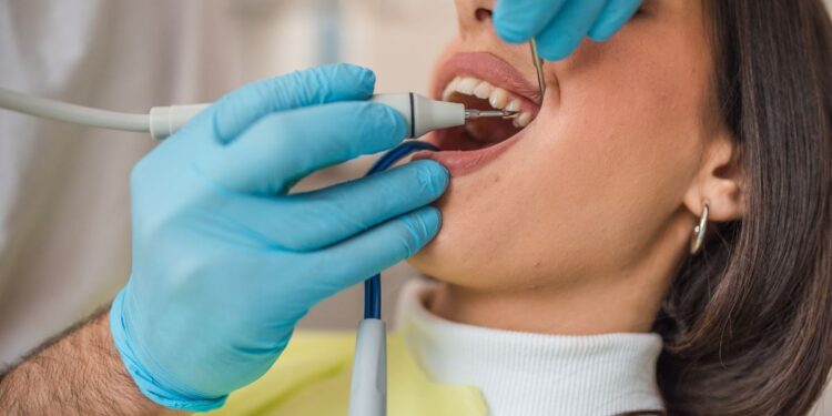 ¿Tienes sarro en los dientes? Descubre cómo eliminarlo y prevenirlo
