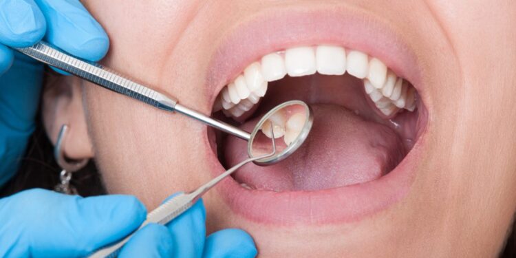 Qué es la profilaxis y por qué es más importante de lo que crees