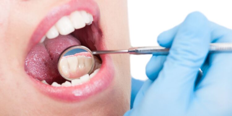 ¿Sensibilidad en los dientes? Puede ser abfracción dental