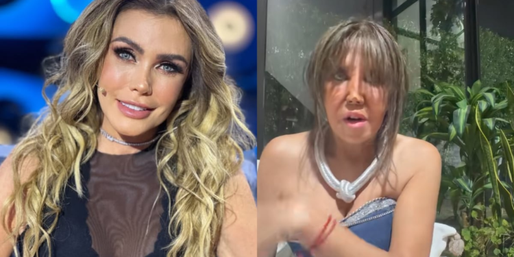 Las redes sociales explotaron por video donde presuntamente aparecía Sabine Moussier con la cara deformada: esto se sabe