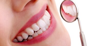 Un blanqueamiento dental profesional: la clave para resultados seguros y duraderos