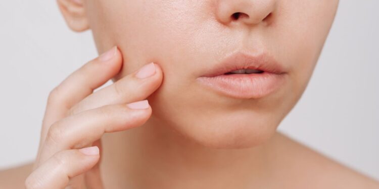 Video | Consejos para cuidar la piel grasa