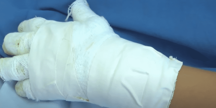 Gobernación del Atlántico refuerza llamado a la prevención tras reporte de 55 lesionados por pólvora durante festividades de diciembre