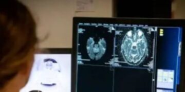 Famosa influencer reveló que sufrió derrame durante grabación