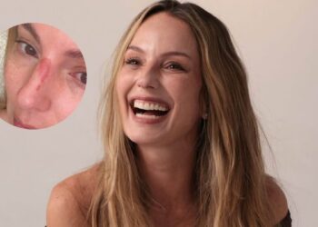 Fotos | La reconocida presentadora Claudia Bahamón sufrió un accidente en Cartagena