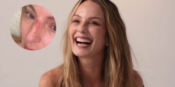 Fotos | La reconocida presentadora Claudia Bahamón sufrió un accidente en Cartagena