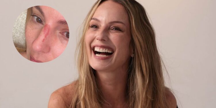 Fotos | La reconocida presentadora Claudia Bahamón sufrió un accidente en Cartagena