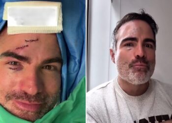 Reconocido actor de ‘Sin senos sí hay paraíso’ sufrió un accidente en medio de una escena