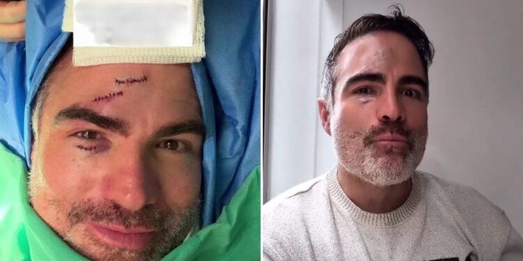 Reconocido actor de ‘Sin senos sí hay paraíso’ sufrió un accidente en medio de una escena