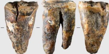 Un diente de 59.000 años de antigüedad ofrece una visión excepcional de cómo los neandertales abordaban un problema médico