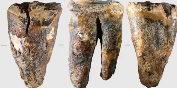 Un diente de 59.000 años de antigüedad ofrece una visión excepcional de cómo los neandertales abordaban un problema médico