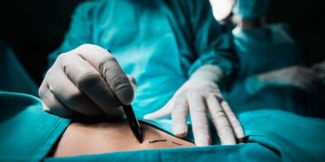 Otra presunta muerte de una mujer después de un procedimiento estético en Barranquilla: ¡laboraba como fiscal especializada!